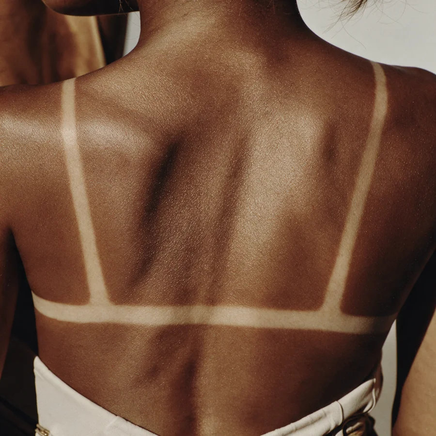 Espalda con bronceado dorado y marcas de bikini — imagen ilustrativa